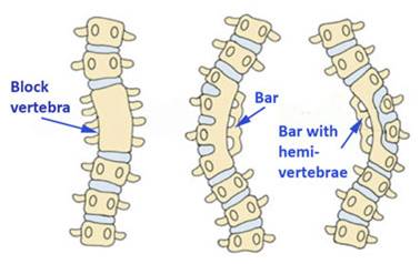 Defects of Segmentation